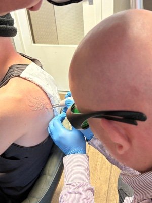 Tattoo removal Limburg Tattoo removal Limburg